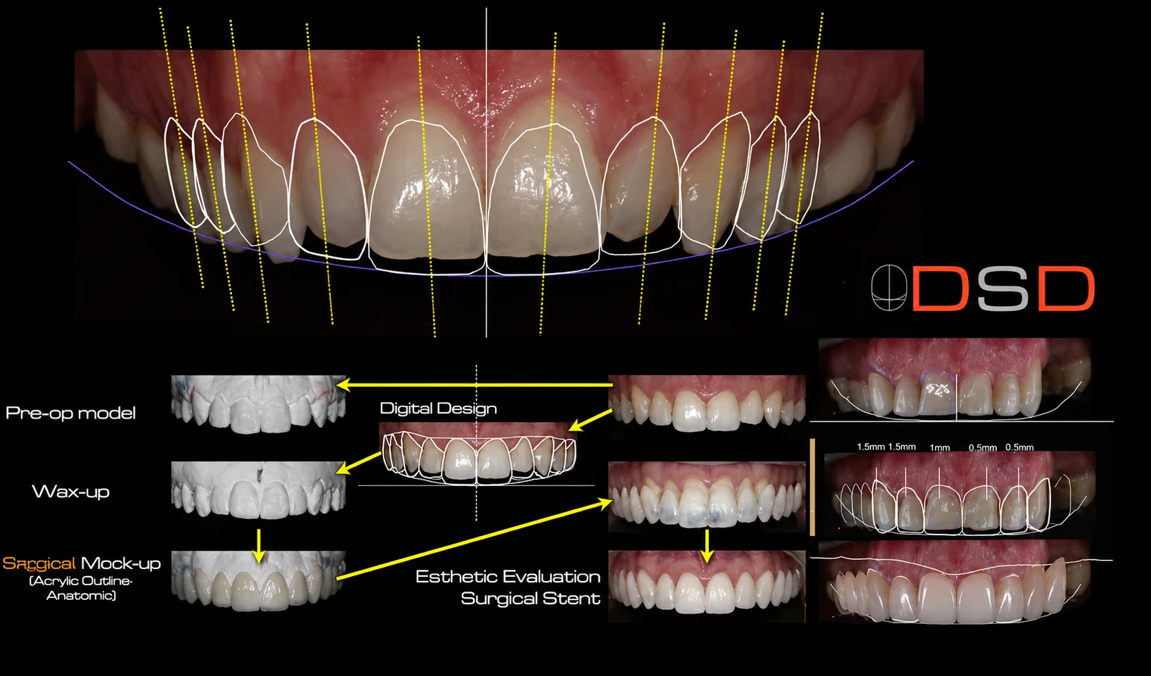 Digital Smile Design treatment planning board
