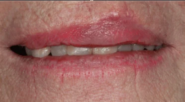 After emergency dental treatment