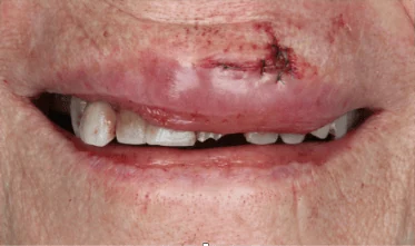 Before emergency dental treatment