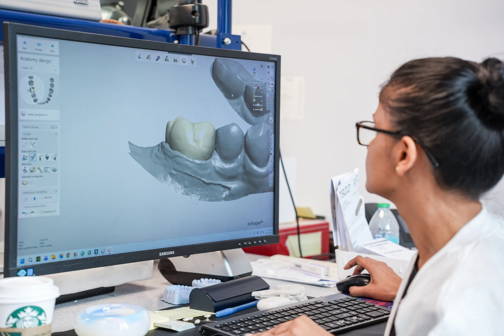 Digital dental design at Shapiro Dental Group