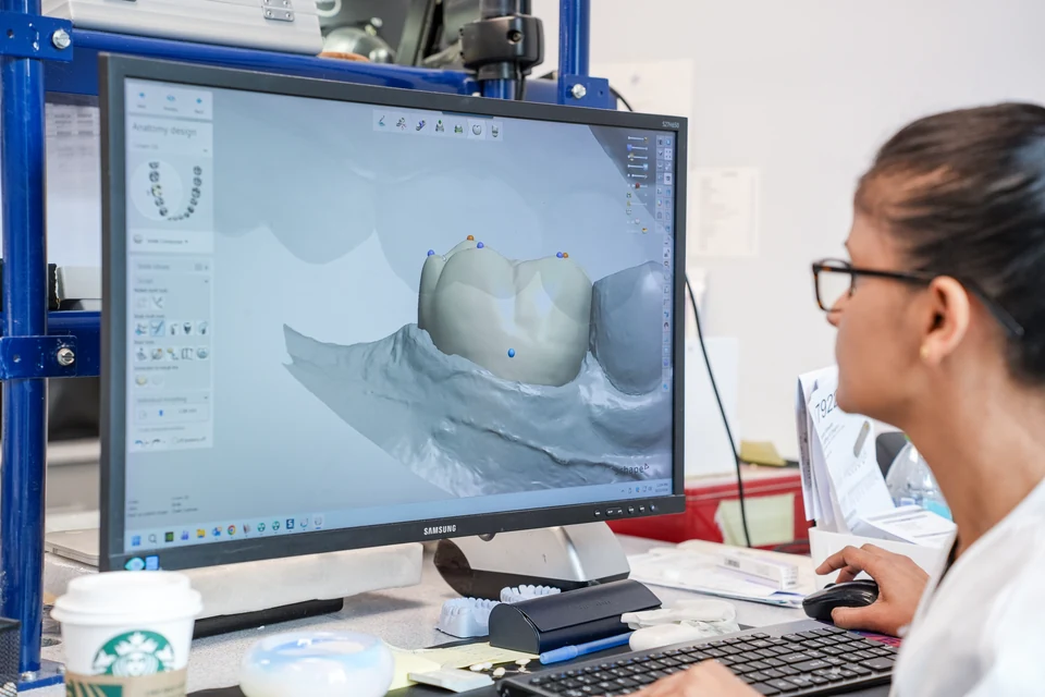 Digital dental design in the in-house laboratory