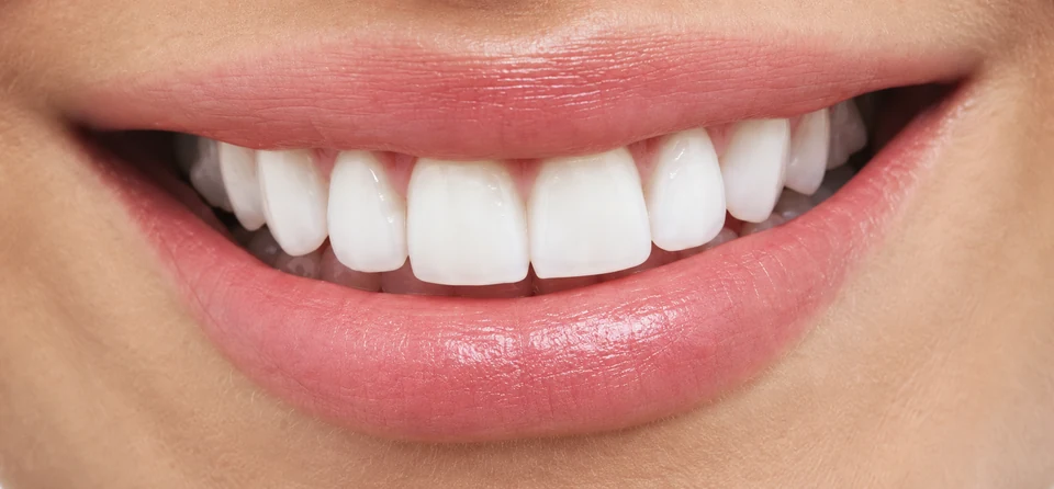 Cosmetically contoured smile
