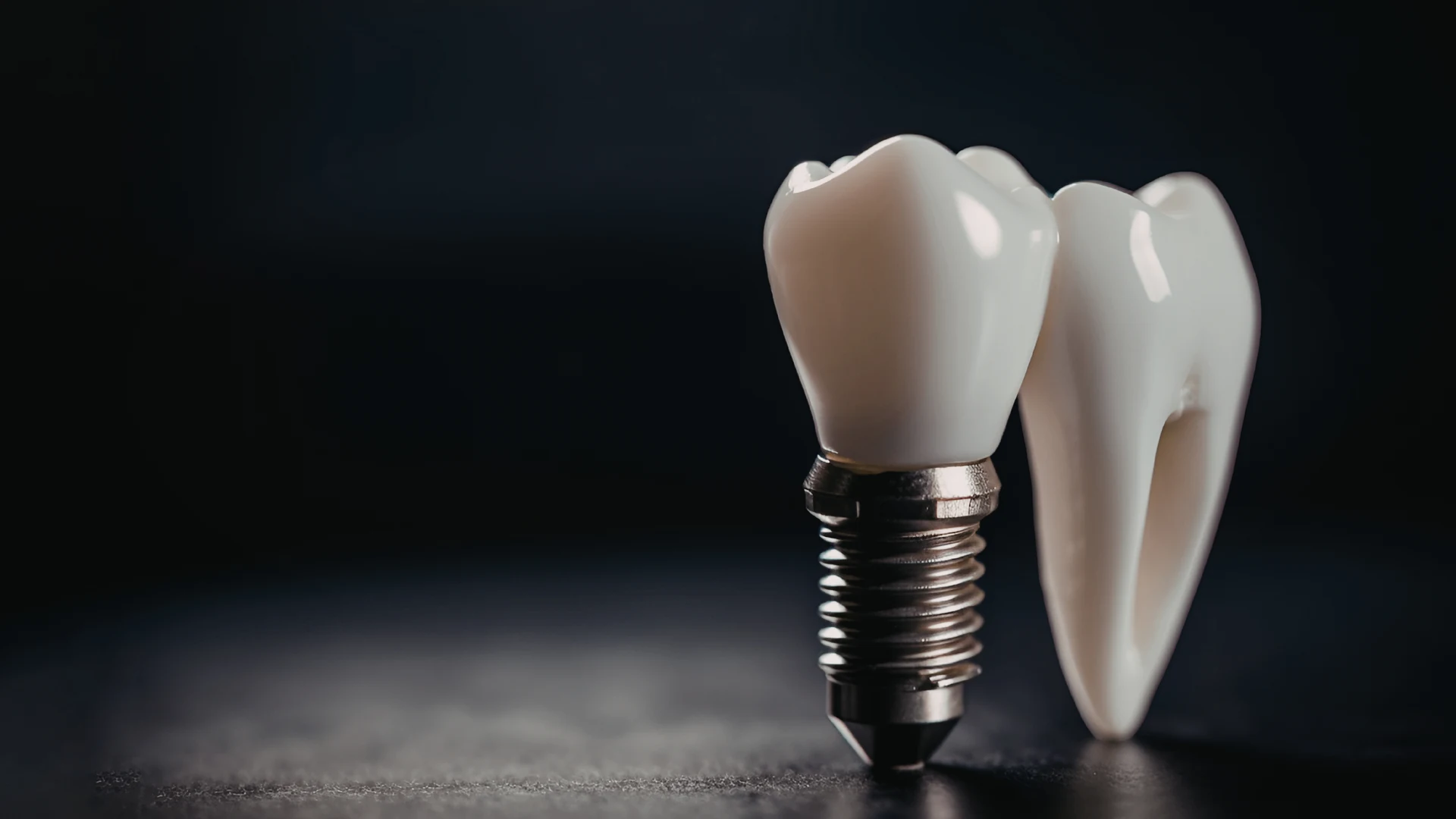 Dental implant illustration