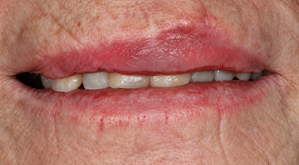 After emergency dental treatment