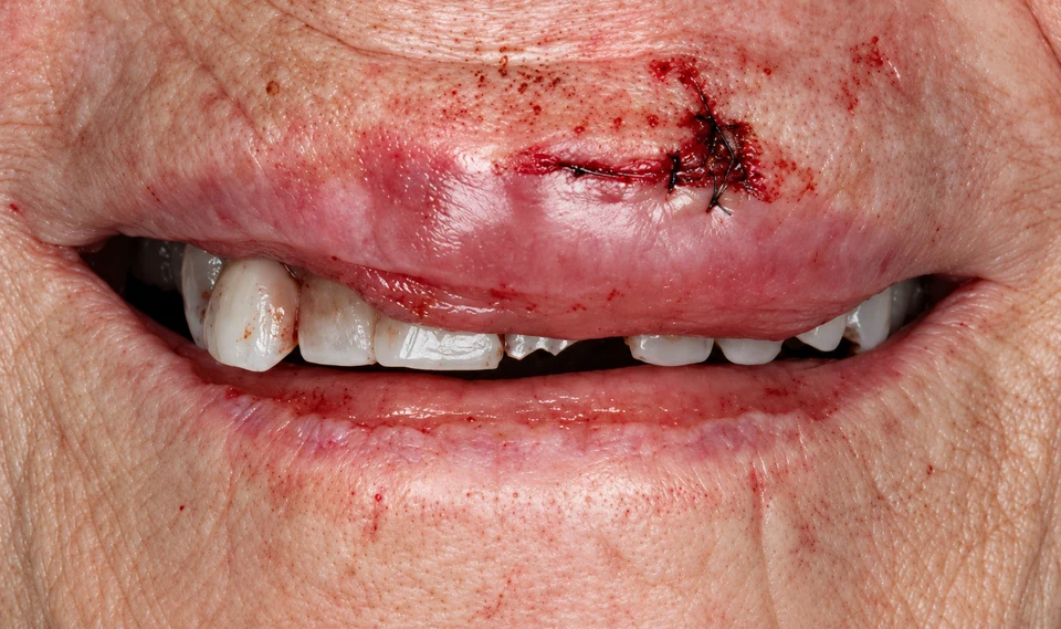 Before emergency dental treatment