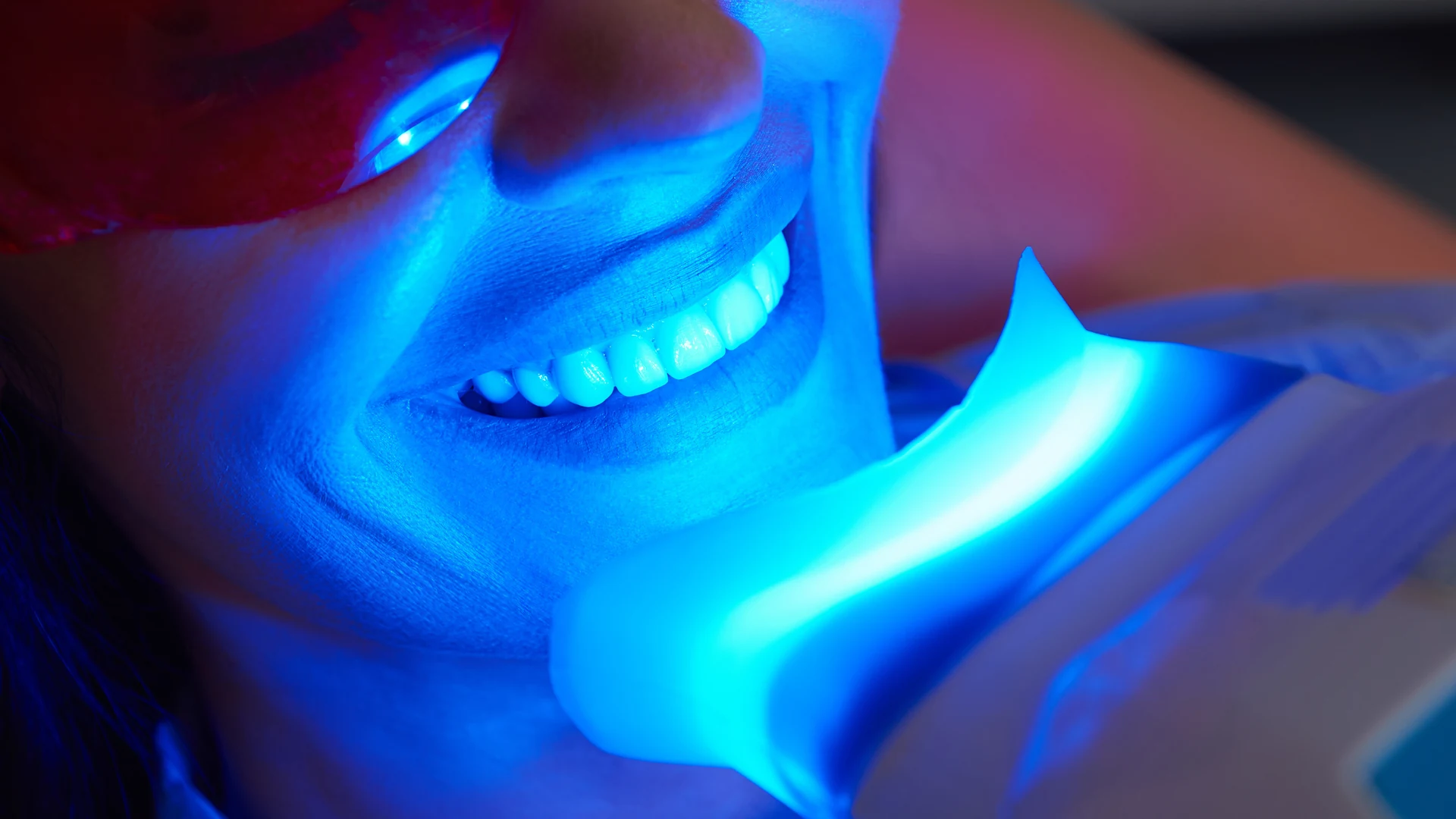 Professional teeth whitening treatment