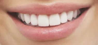 Cosmetically contoured smile