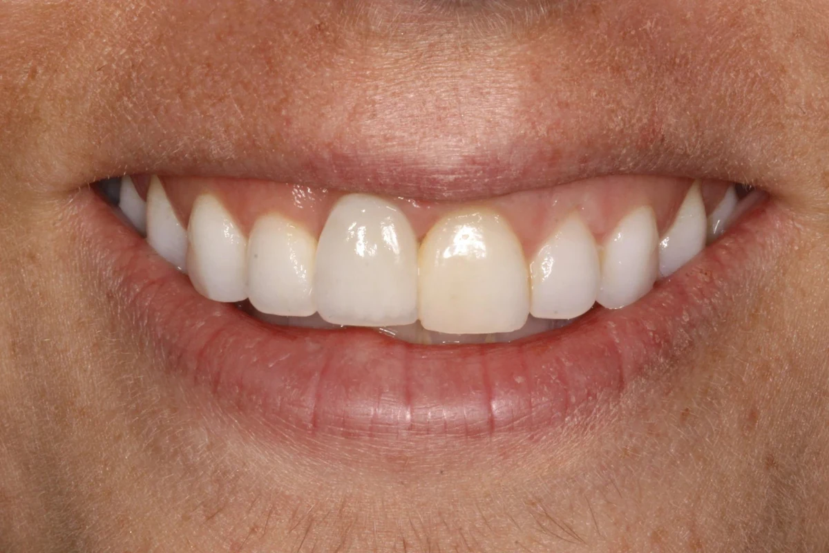Case 1 before treatment