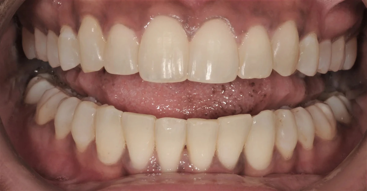 Case 2 after treatment