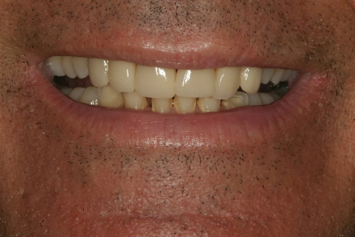Case 3 before treatment