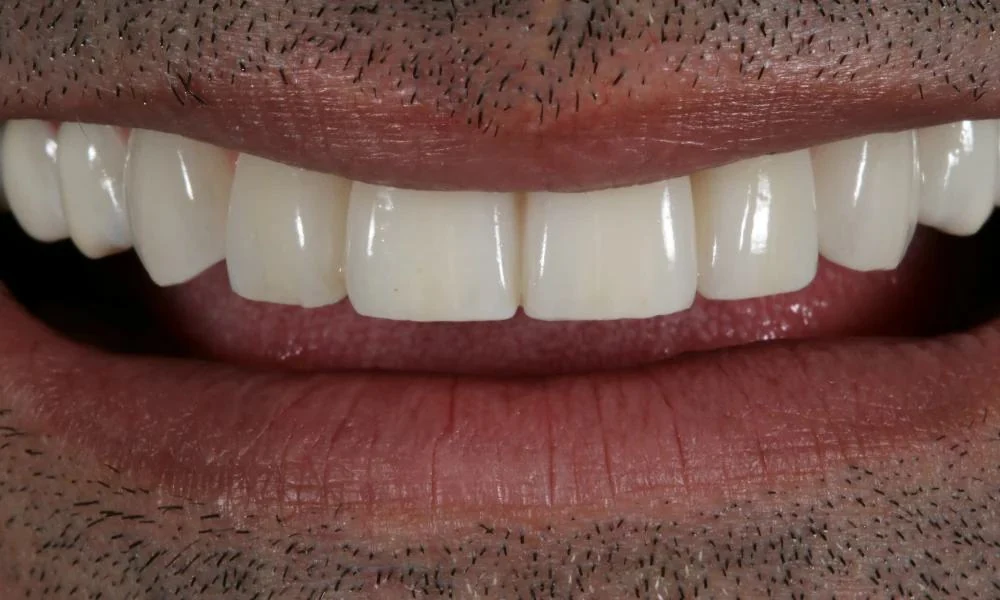 Case 4 after treatment