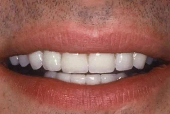 Case 5 after treatment