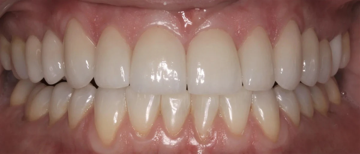 Case 6 after treatment