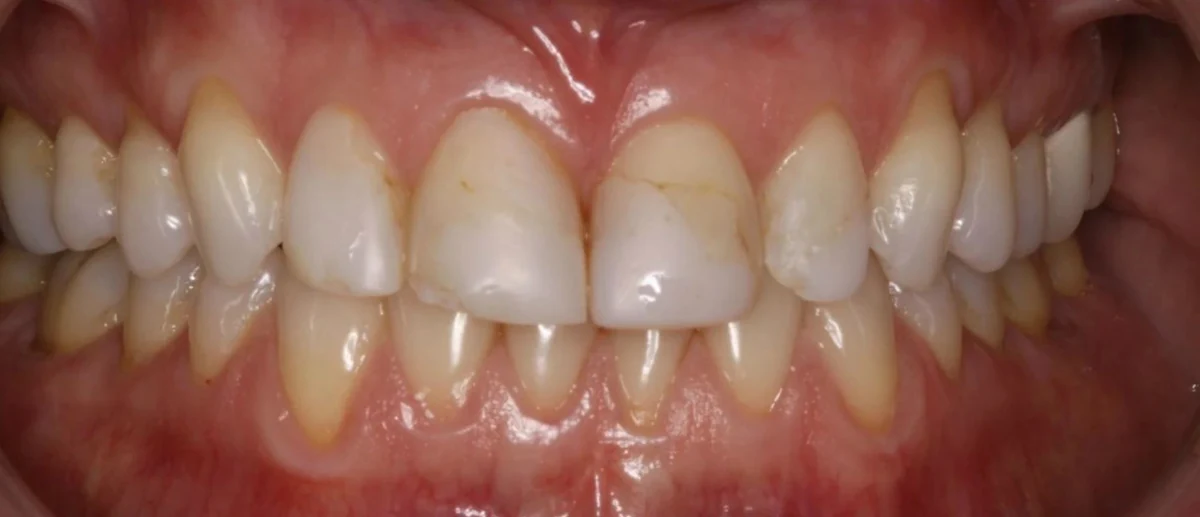 Case 6 before treatment
