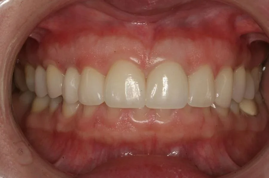 Case 7 after treatment