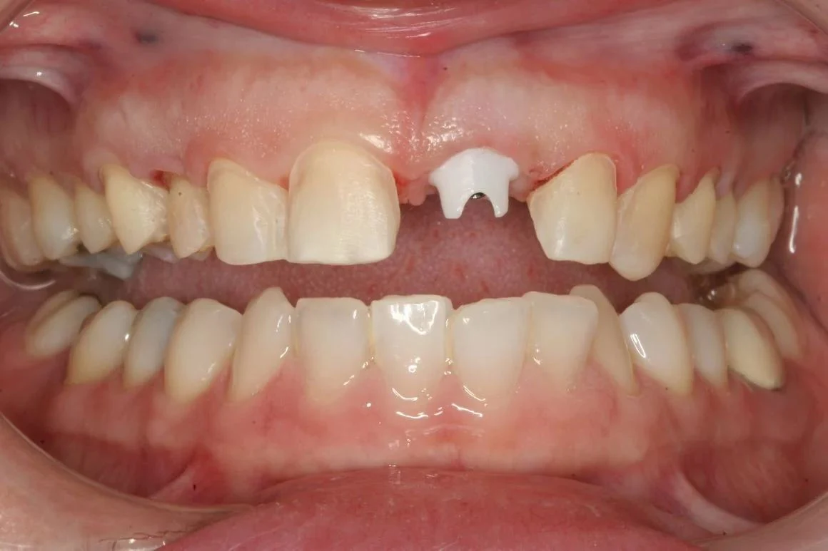 Case 7 before treatment