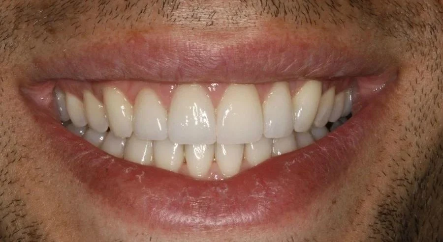 Case 8 after treatment