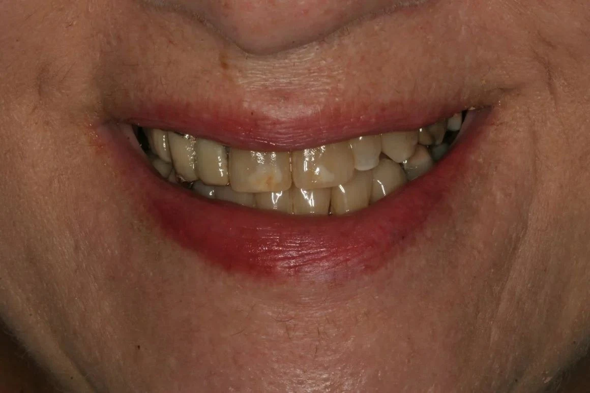 Case 8 before treatment