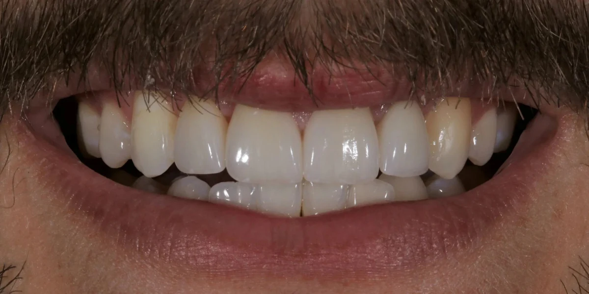 Case 9 after treatment