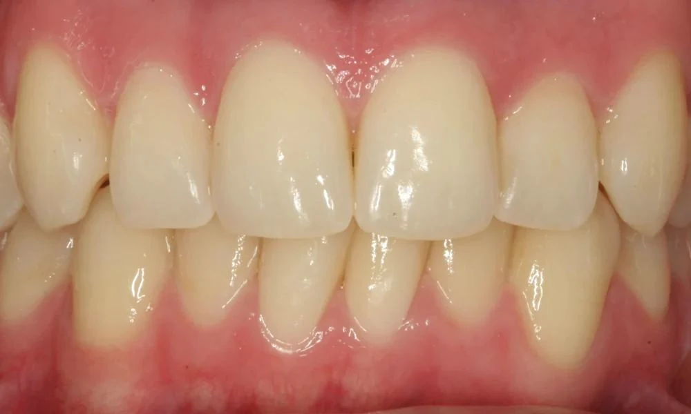 Case 10 after treatment