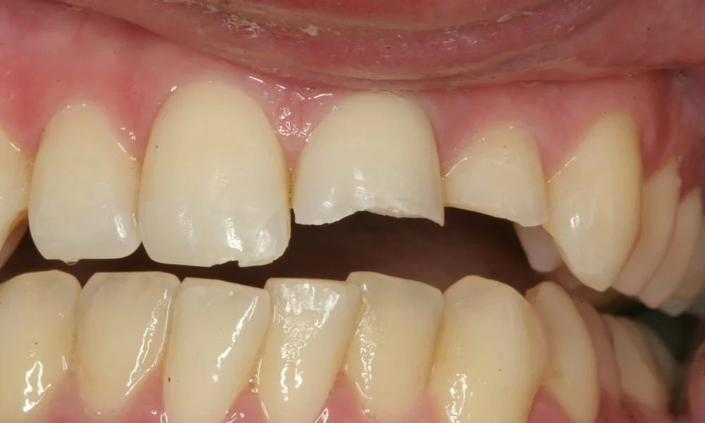 Case 10 before treatment