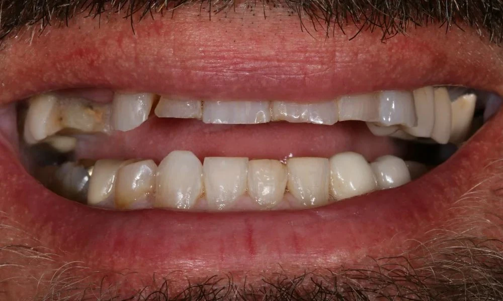 Case 11 before treatment