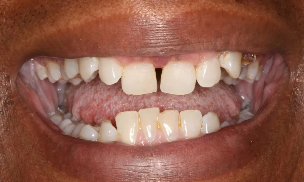 Case 12 before treatment