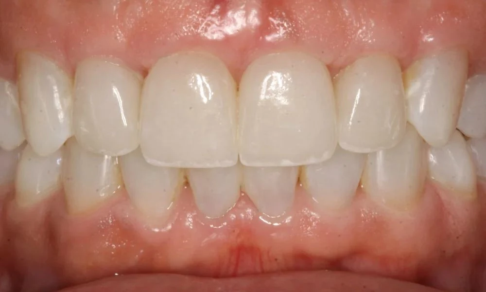 Case 15 after treatment