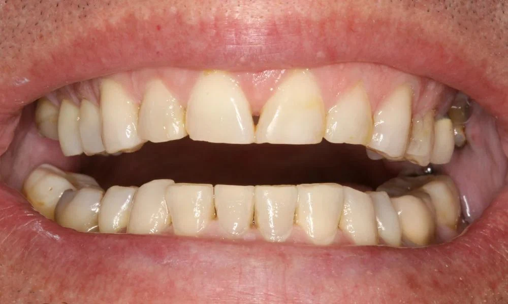 Case 15 before treatment
