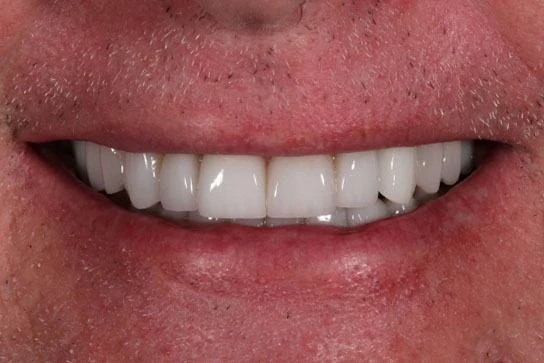 Case 16 after treatment