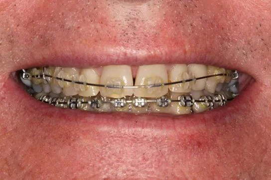 Case 16 before treatment