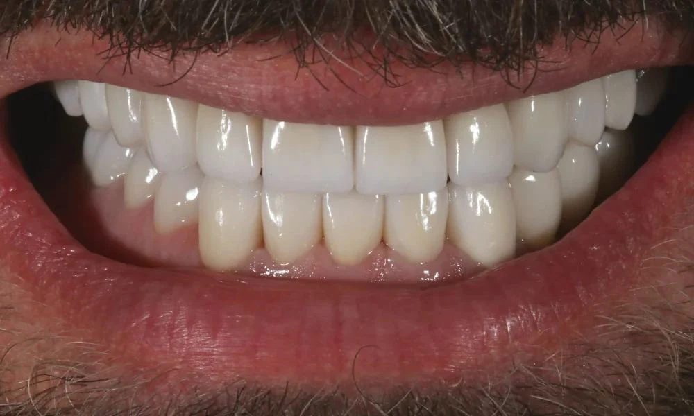 Case 18 after treatment