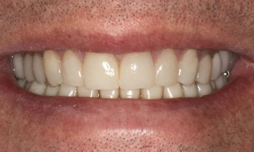 Case 18 before treatment