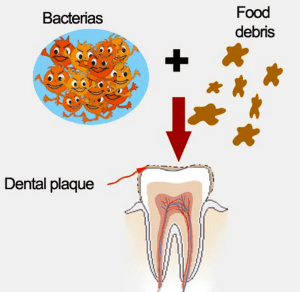 Hidden sugars in foods - Shapiro Dental Group