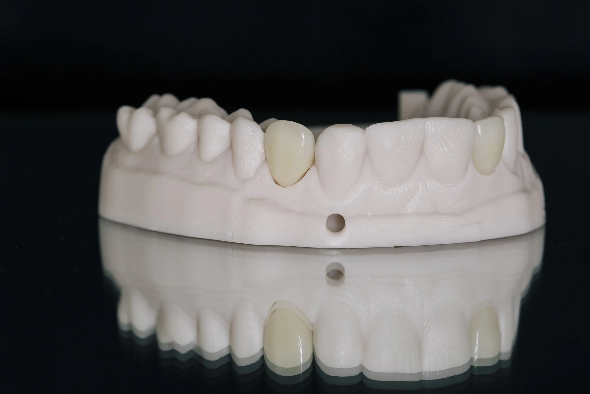 Teeth | Shapiro Dental Group