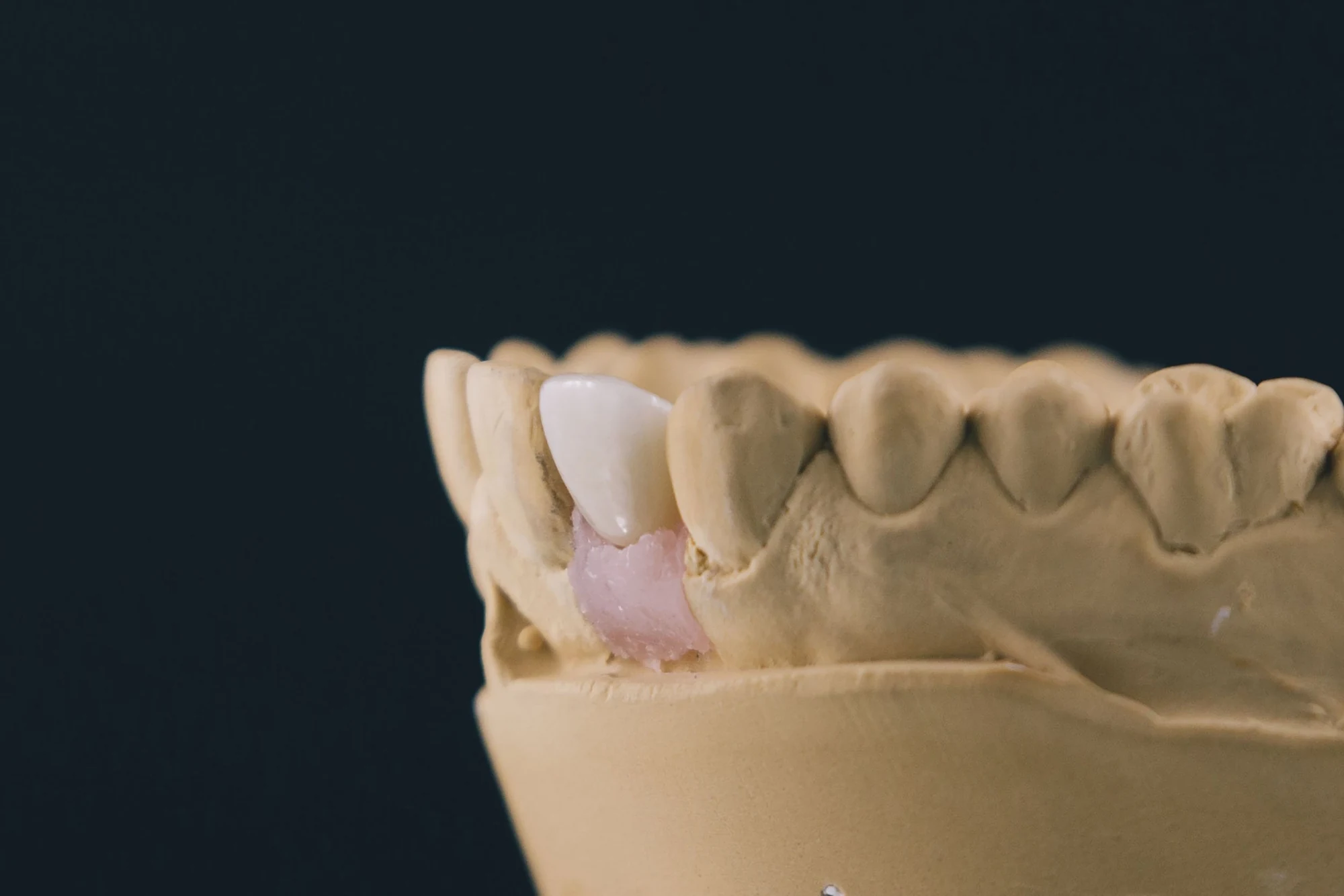 Teeth | Shapiro Dental Group