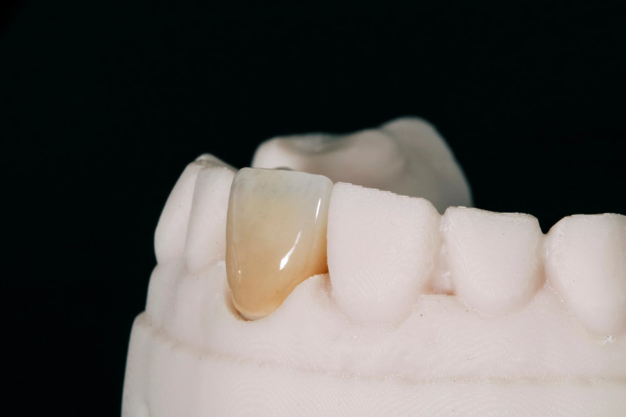 Teeth Problems | Shapiro Dental Group