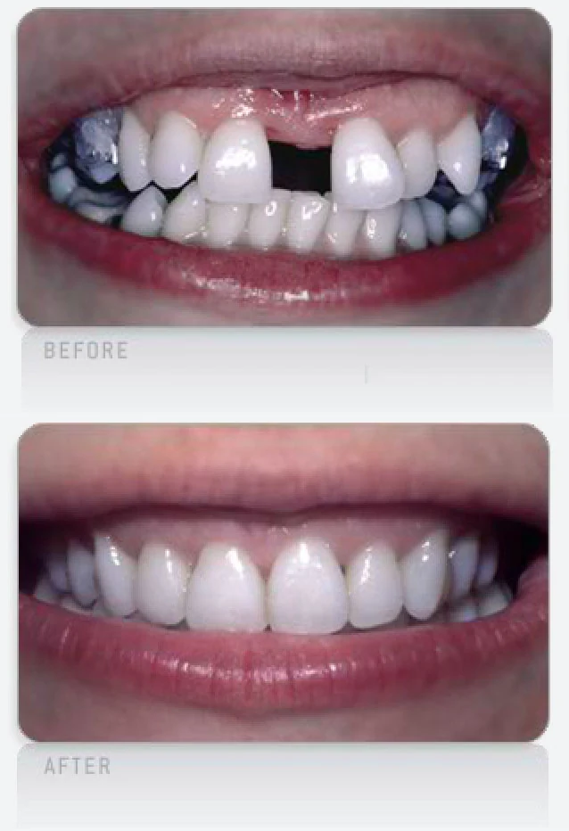 Making Dramatic  Transformations going beyond expectations achieving a confident natural smile 